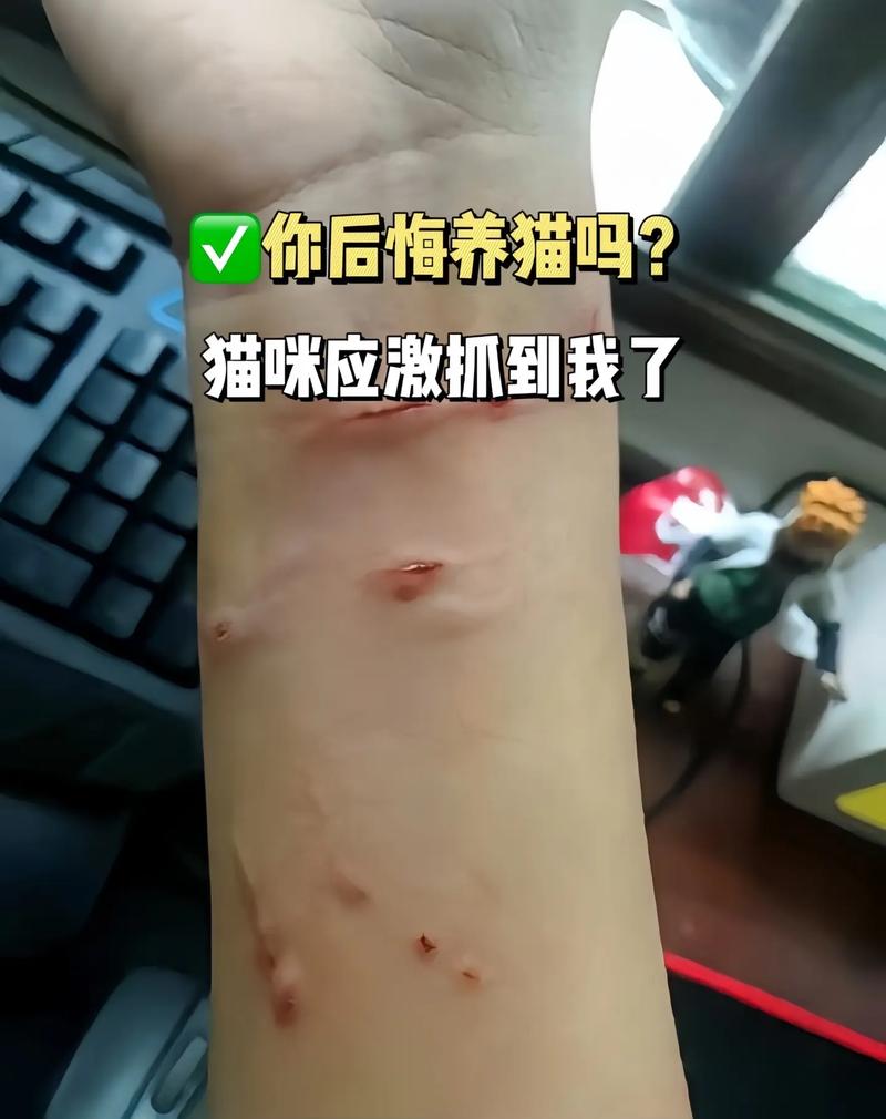 猫抓出血要当心，看疫苗处理伤口（家里养的猫挠了没事吧）