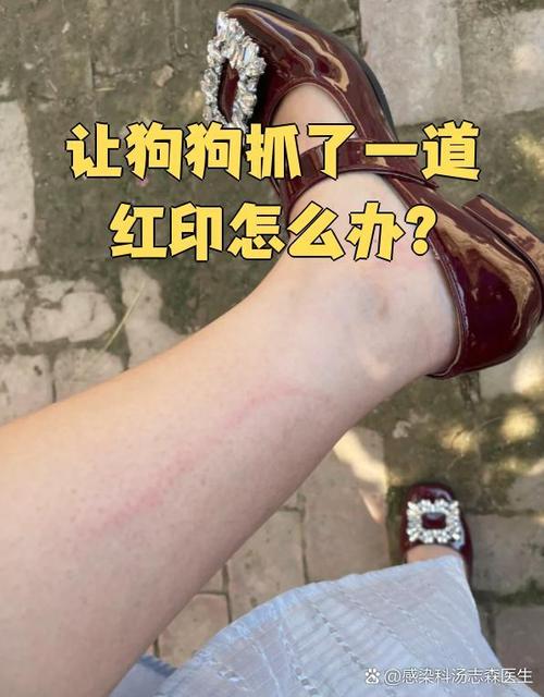 小狗爪划伤红印？别大意，注意消毒观察！（被小狗爪子划了一条红印没出血）