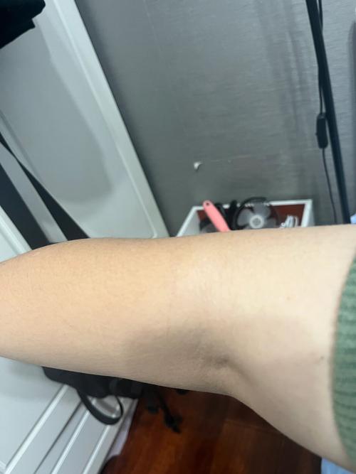 猫咪爪伤虽小要当心，及时处理判断是否就医（不小心被家养的猫划出了一毫米的口子）