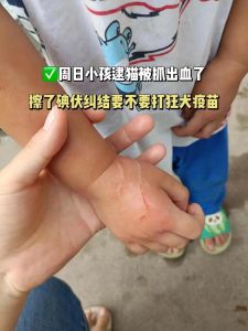 小猫抓伤别大意，及时处理防感染（家里养的小猫挠了有事吗）