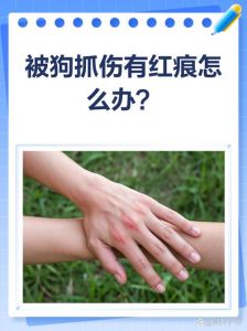 新狗抓妹妹怎么办？注意处理防感染（被自家养的宠物狗抓伤了）