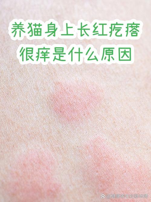 减少猫毛过敏，家居清洁和互动防护（猫毛过敏怎么缓解）