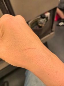 布偶猫抓伤后处理与疫苗防疫（布偶被野橘猫抓伤爪子）
