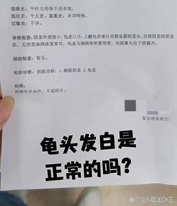 龟头白斑原因多，注意清洁防感染（龟的头上有白斑是怎么回事）