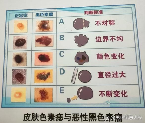 注意这些健康小信号（龟的头上长了黑斑图片）