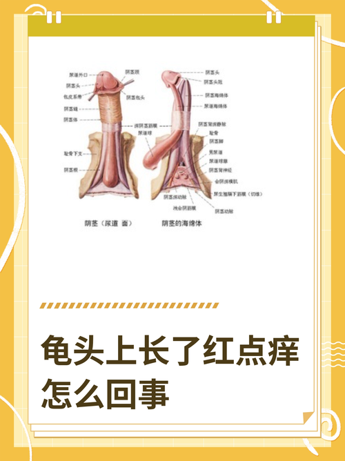 龟头红斑是什么原因引起的？（龟的头上长了红斑图片）