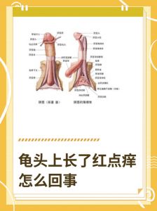 龟头红斑是什么原因引起的？（龟的头上长了红斑图片）