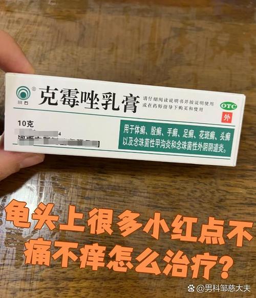 龟头湿疹症状多样，需综合治疗（龟 头上湿疹图片）