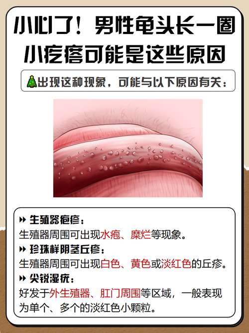 龟头小疙瘩是什么？快速自查男女常见原因（男生龟的头上长一圈小疙瘩是什么）