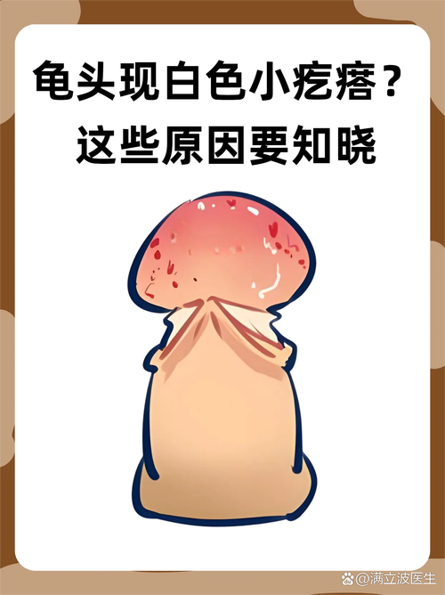 龟头湿疹症状多样，需综合治疗（龟 头上湿疹图片）