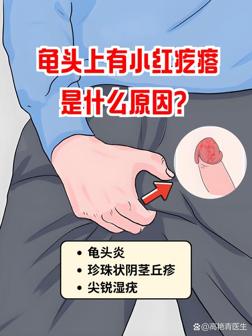 龟头小红点不痛？别大意，快查查原因！（龟 头上小红点不痛不痒）