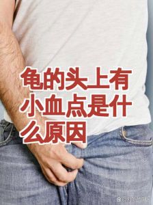 龟头红点？炎症惹的祸，及时就医早治疗！（龟的头上有小红点图片）