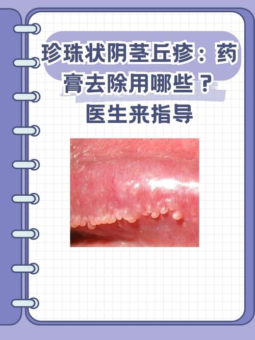 珍珠状小疙瘩，一般无需治疗（龟的头上珍珠疹图片）