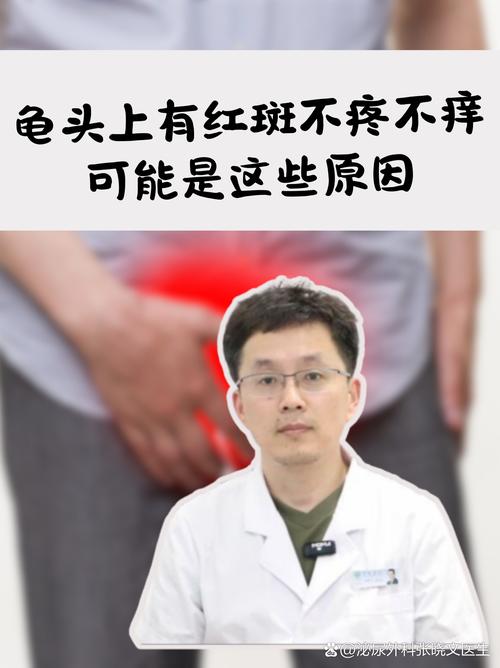 龟头红斑是什么原因引起的？（龟的头上长了红斑图片）