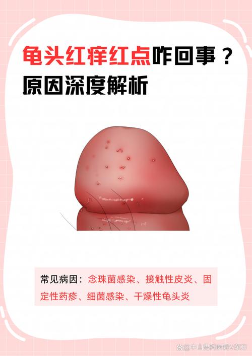 龟头红点？别慌，快看医生！（龟的头上长了红点怎么回事）