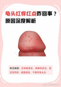 龟头红点？别慌，快看医生！（龟的头上长了红点怎么回事）