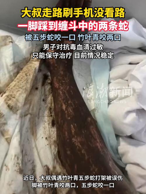 男子被双蛇咬伤,直播主林岩虚拟困境引发思考(男子遇竹叶青五步蛇打架) 男子被双蛇咬伤,直播主林岩虚拟困境引发思考(男子遇竹叶青五步蛇打架)