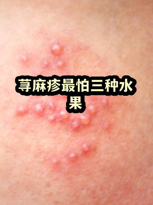 龟头敏感高?冷水摩擦刺激物惹的祸!(龟敏最怕的三个东西) 龟头敏感高?冷水摩擦刺激物惹的祸!(龟敏最怕的三个东西)