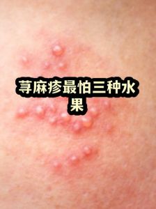 龟头敏感高？冷水摩擦刺激物惹的祸！（龟敏最怕的三个东西）
