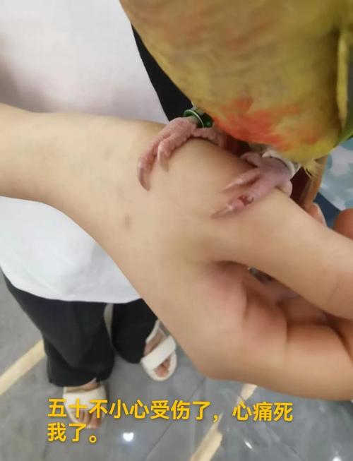 鹦鹉受伤流血怎么办?(鹦鹉受伤流血怎么处理) 鹦鹉受伤流血怎么办?(鹦鹉受伤流血怎么处理)